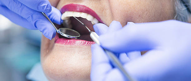 Best Emergency Tooth Extraction in Speers, PA